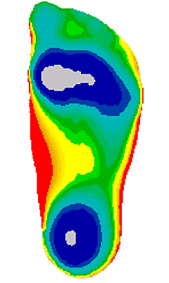 3D Fußsohle